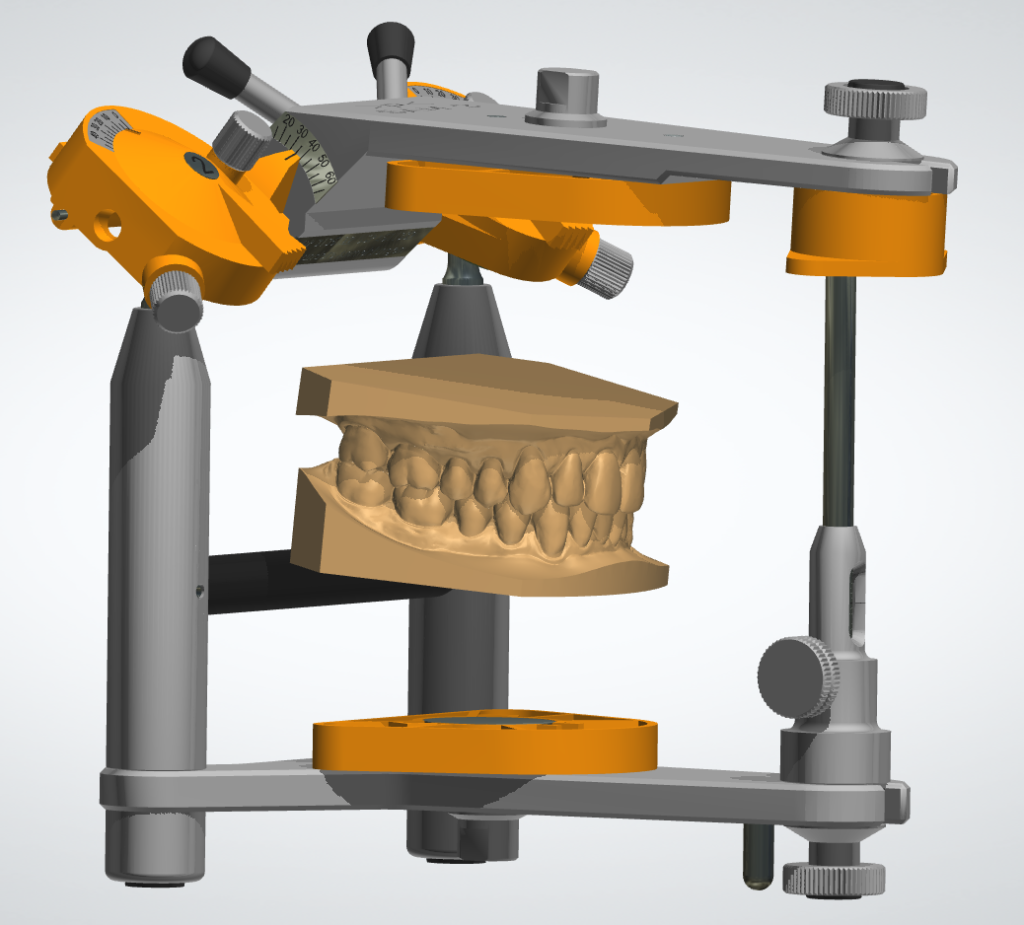 articulator